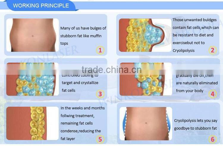 cryolipolysis cool shaping machine / cryolipolysis slimming with RF CAVITATION multifunction system