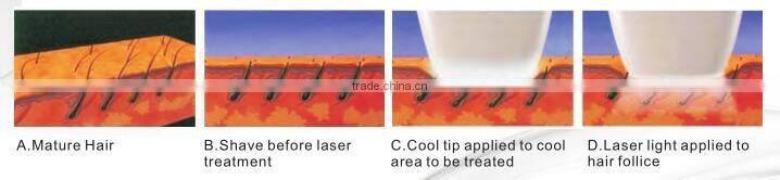 Factory price high quality home use hair removal for Hair Removal beauty equipment&machine