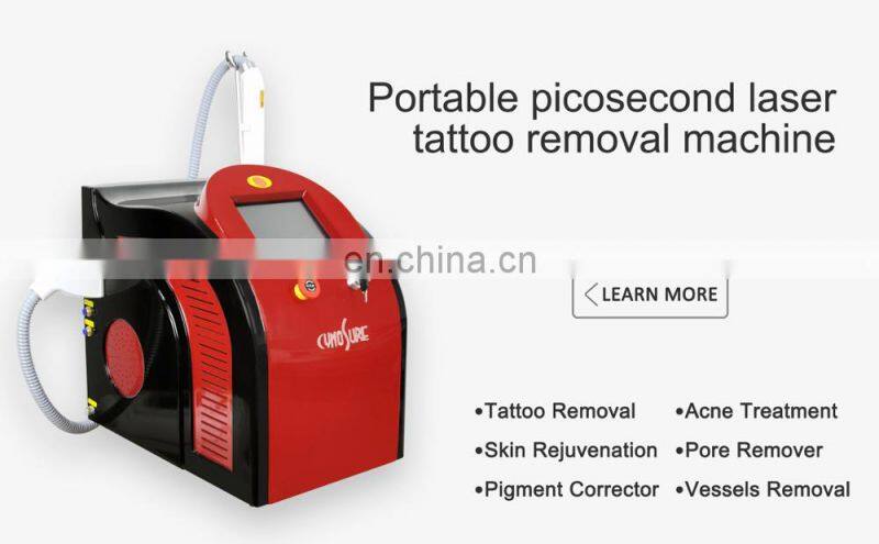 Vertical 1064nm 532nm Q-Switch ND YAG Laser Tattoo Removal Machine Carbon Peel
