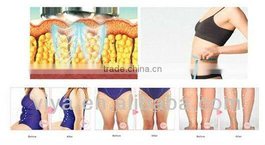 VY-G5 Vibration machine crazy fit massage manual G5 massage