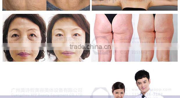 Hot Selling Vshape - Vacuum Slimming Machine (B0452)