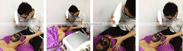 Best Pigment Removal Tattoo Removal Vertical Ipl Rf Nd Yag Laser Hair Removal Machine