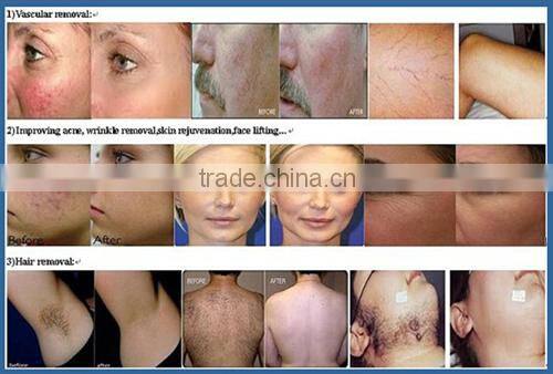 Salon spa use wrinkle removal tightening skin care multifunction machine/portable multifunction facial machine