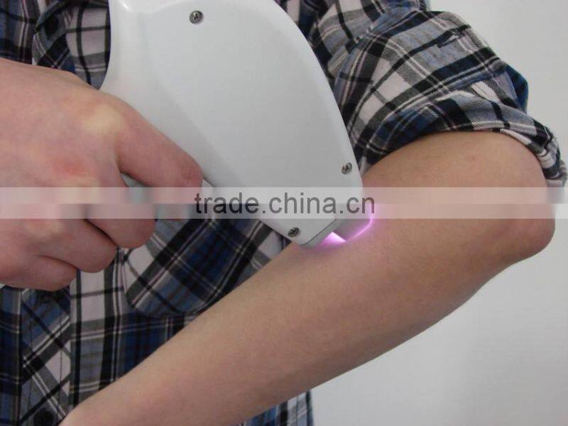 Distributors wanted painless aesthetic device