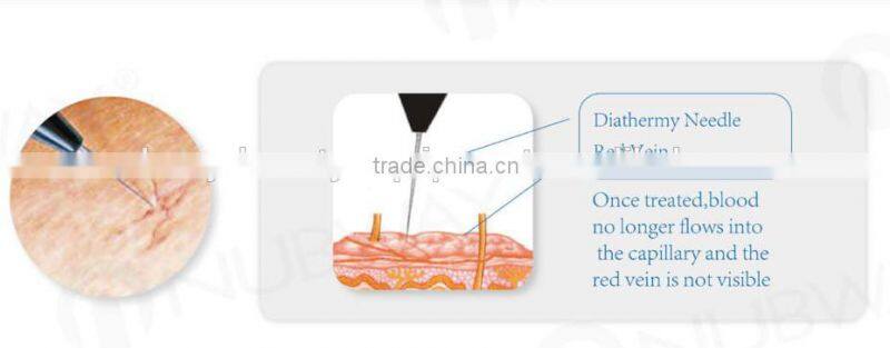 Vascular Treatment Surgical Laser