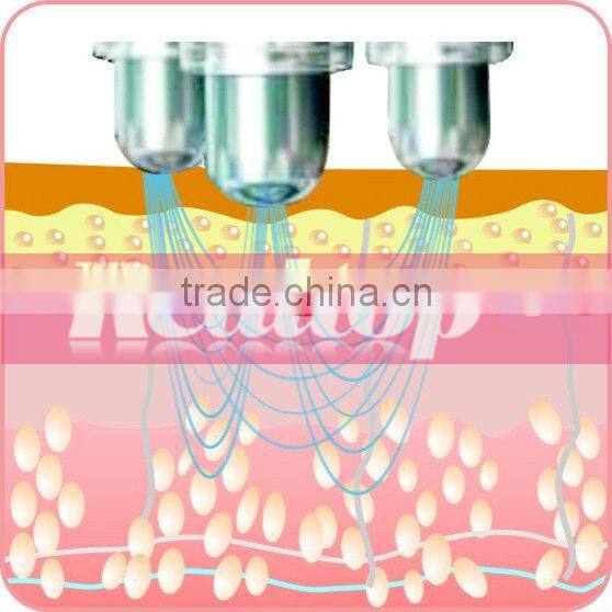 Best rf equipment for facial & eyes lift, tripolar radio frequency machine home use