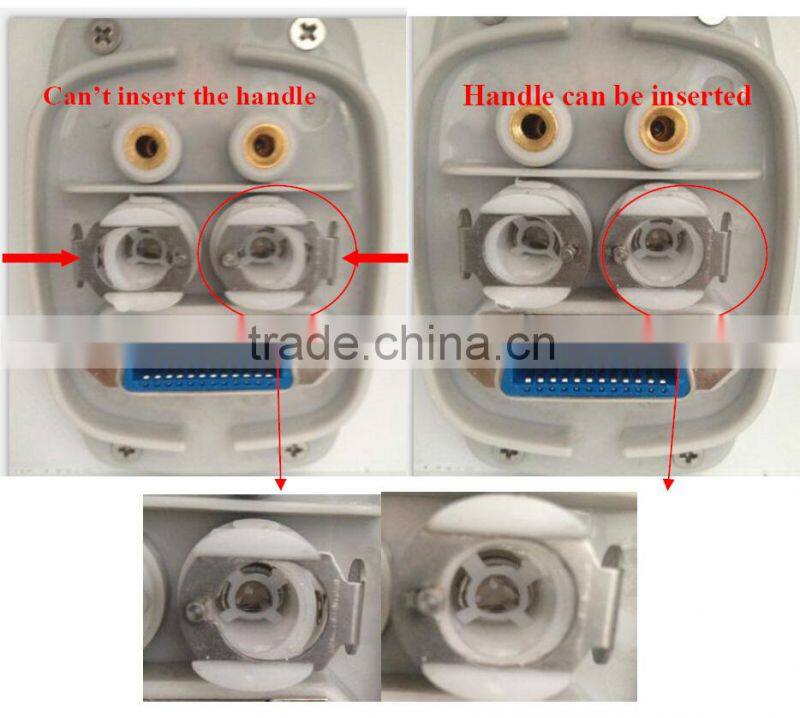 Best 808nm diode laser permanent hair removal machine price