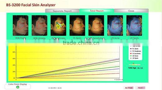 2014 Newest computer skin analyzer Suitable For Windows 8 and windows 8.1