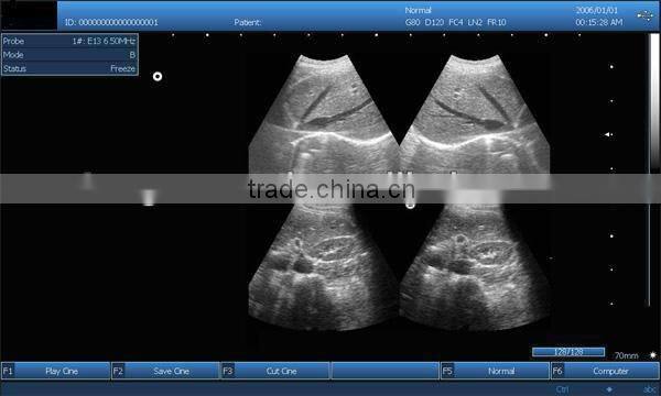 professional ultrasound devices with 3d