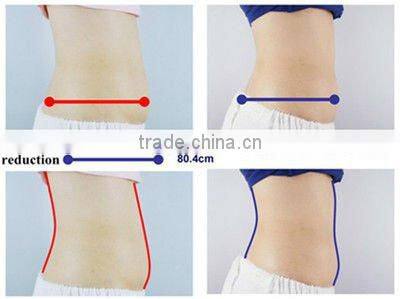 vaser liposuction machine