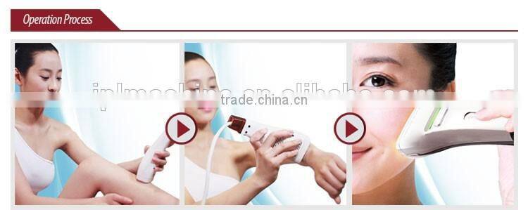 Hot selling hair removal device home use