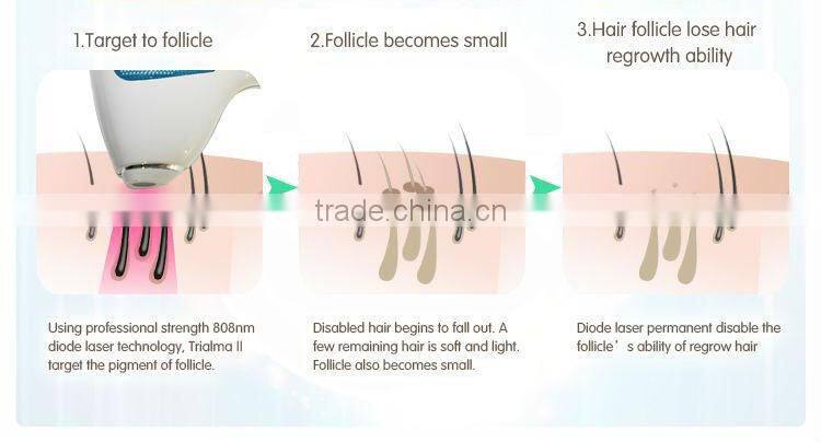 The Best permanent laser hair removal machine for hair removal