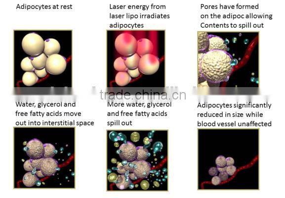 lipo laser/Winkonlaser lipo laser/double wavelengths lipo laser
