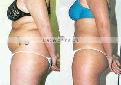 High-power portable Lipo Laser Slimming Machine