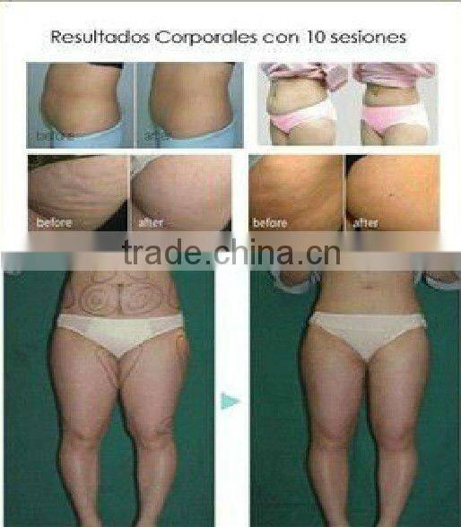 VY-M2 Hot sale ultrasonic body beauty slim massager machine