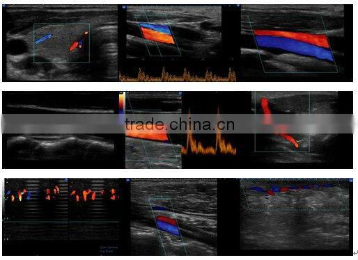 3D and 4D Color Doppler with 4D Real Time Live Probe iSpark 480plus/option Trans-vaginal Array Probe (180)