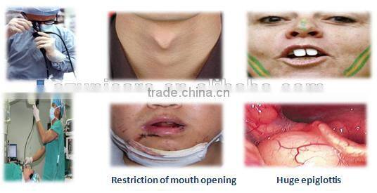 2.2 mm Working Channel Flexible Video Medical Endoscope Camera Endoscopy Compare Fiber Optic Video Olympus Bronchoscope