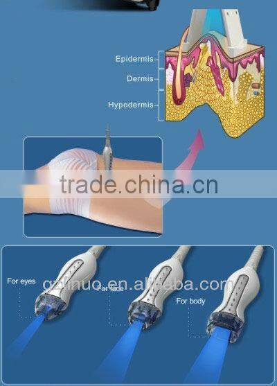 2013-2017 popular new technology RF laser vacuum laser skin treatment machine (The newwest technology !!!!!!!!!)