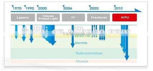 Hot hifu with medical CE