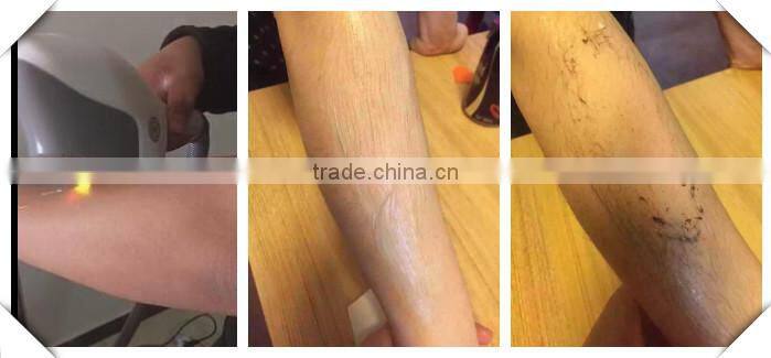 big light spot home use portable shr ipl hair removal beauty equipment