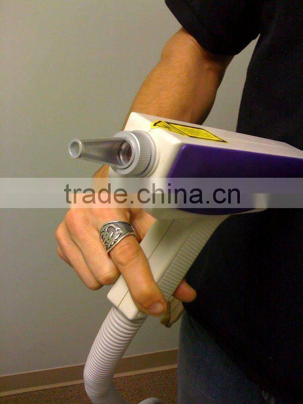 tattoo removal laser mobile spa equipment for tattoo removal