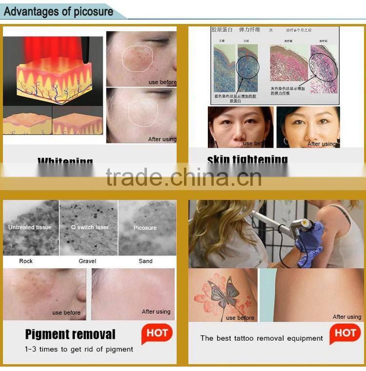 q-switch nd yag laser advanced import&export surgical product / skin tightening machine