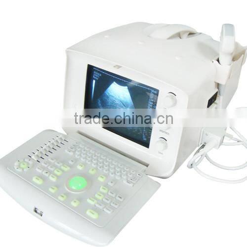 2016 Quality Digital Portable Ultrasound Scanner/Machine VET/ veterinary Ultrasound Scanner-RUS-6000V