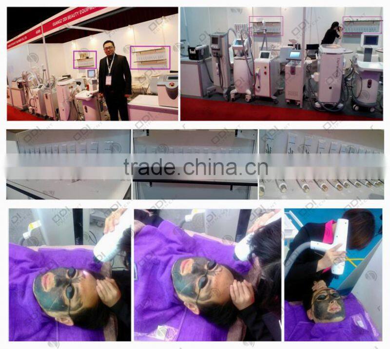 Black Doll skin rejuvenation skin whitening acne treatment for q swithch nd yag laser carbon black