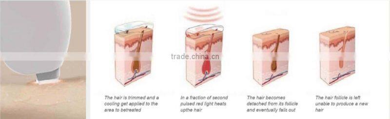 Diode laser dark skin hair removal! spa touch 2 laser hair removal machine