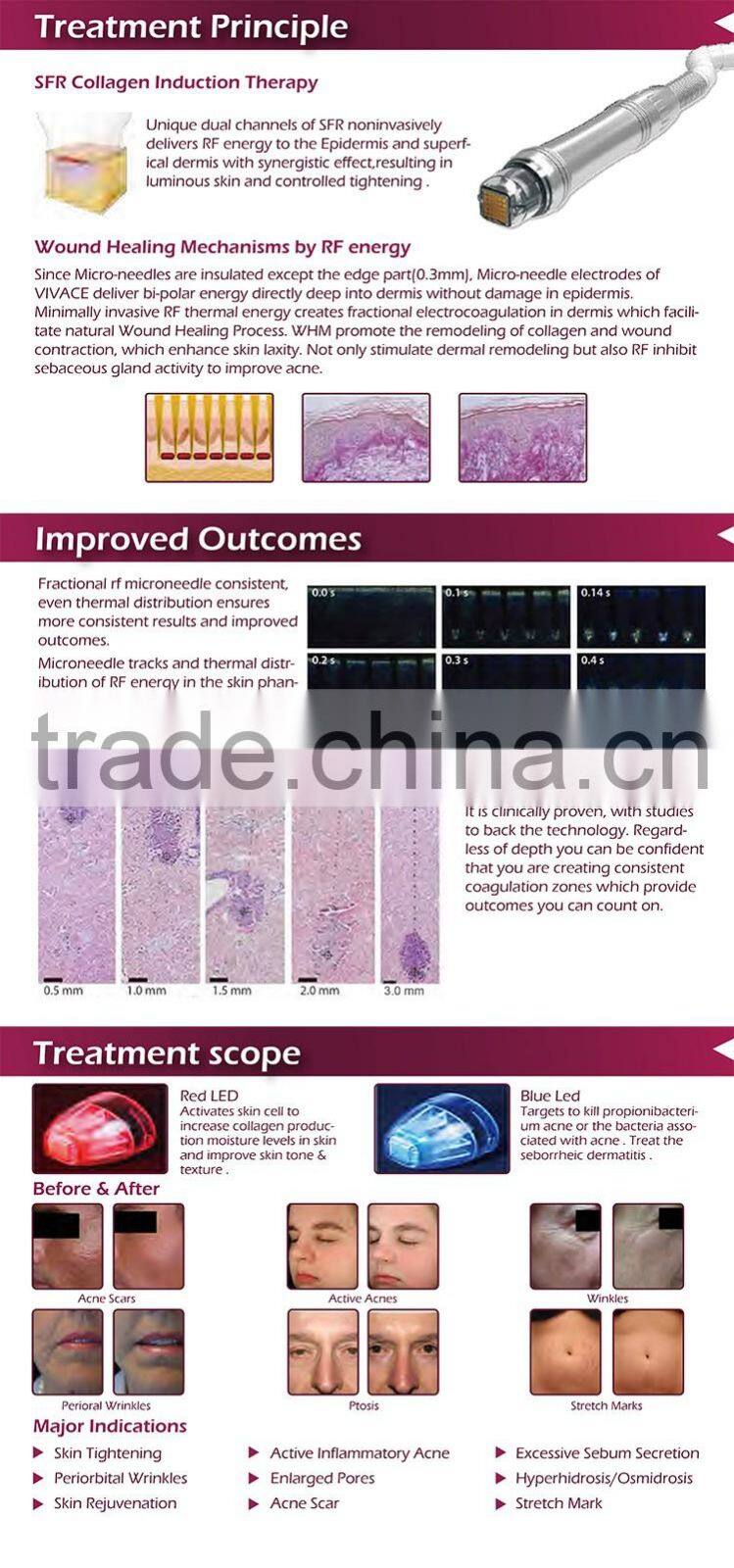 Easy to delegates microneedle fractional rf machine radio frequency facial