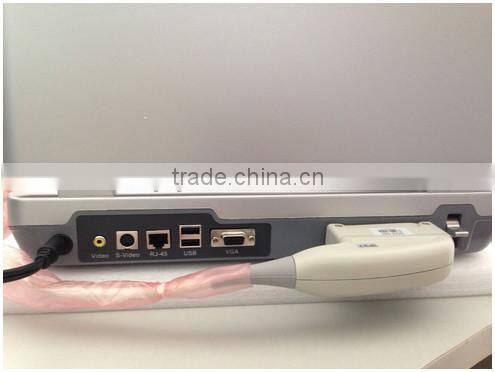 (MSLCU18)3D 4D handheld Color Doppler Medical Ultrasound Scan Machine
