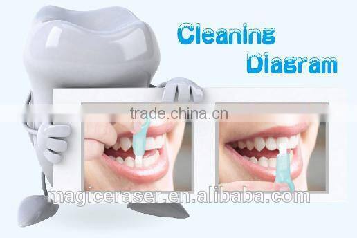 New Product 2014, Magic Teeth Whitening Kit, Alibaba Express