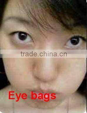 eye bag-dark circle -skin lifting around eyes -eye care system