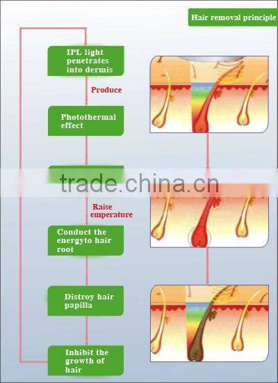 2015 top seller laser beauty equipment laser for hair loss