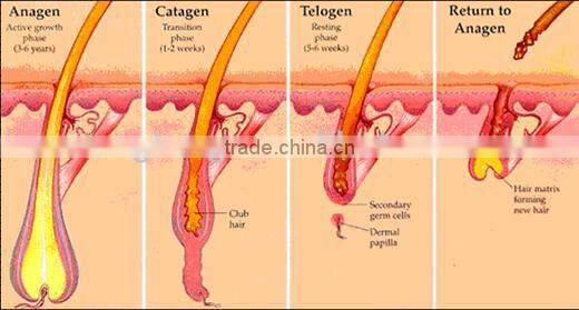 2015 top seller laser beauty equipment laser for hair loss