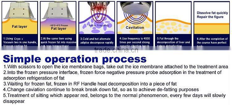 6 Handles cryolipolysis weight loss machine/Cool tech Fat Freezing slimming machine home device