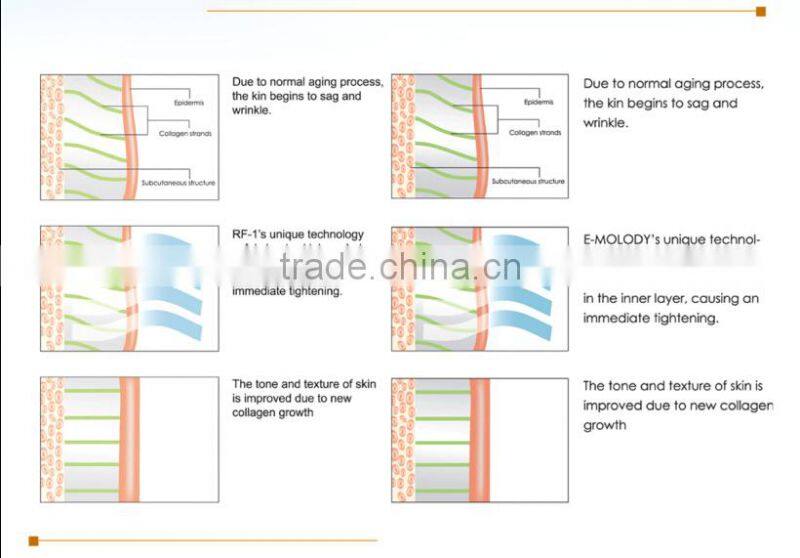 multi-functional RF/40K/ beauty machine Made in China Home&salon use
