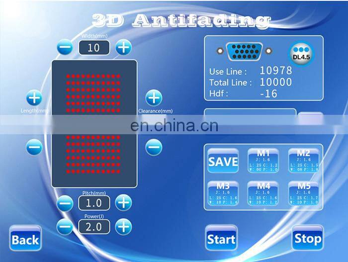 Portable Ultrasonic 3D Anti-aging High Intensity Slimming Machine Face Lifting Wrinkle Removal