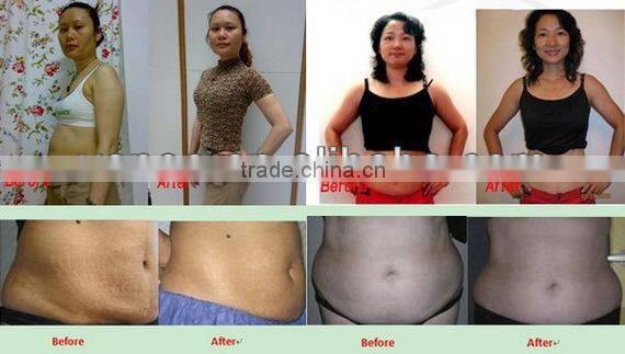 Economic cavitation rf machine ( paypal accept)