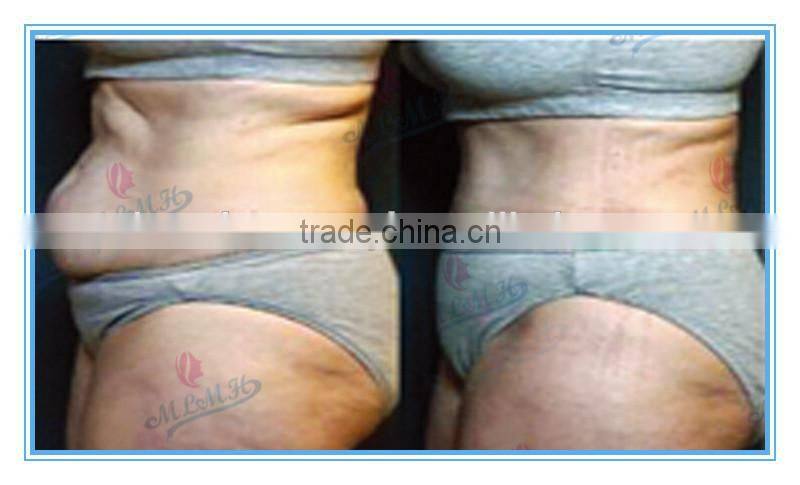 AICHUN slim cream products herbal fat burning slim cream 200ML with hot chili