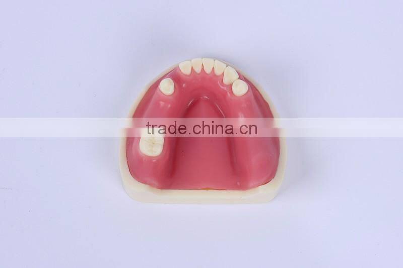 New Type Good Quality Dental Implant Model with teeth