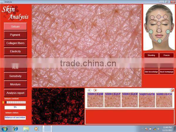 New Product Portable Facial Skin Analyzer Beauty Equipment