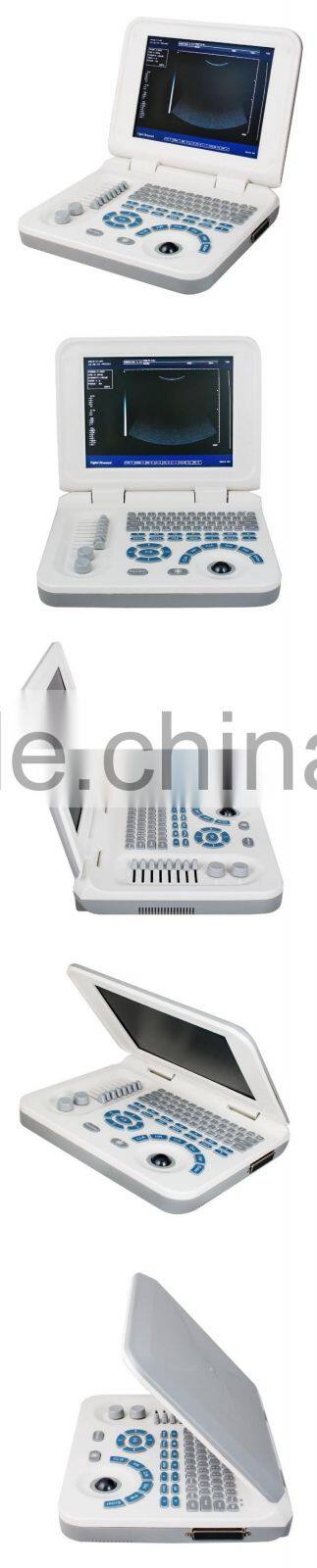 2016 New design! Full digital medical portable notebook laptop ultrasound machine/system with low price-Shelly