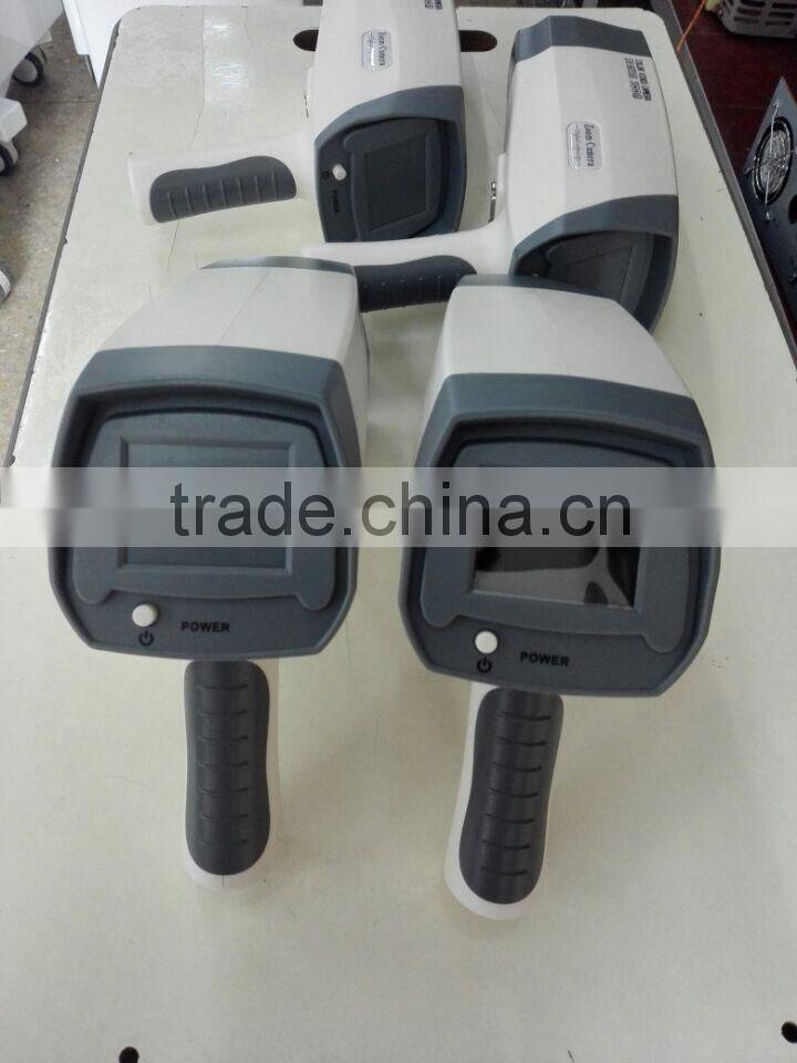 Digital Video Colposcope, Laptop Video Colposcope, Gynecology Video Colposcope