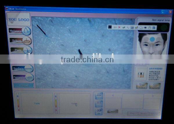 Portable Faical Skin Analysis Machine 3D TM-HT907