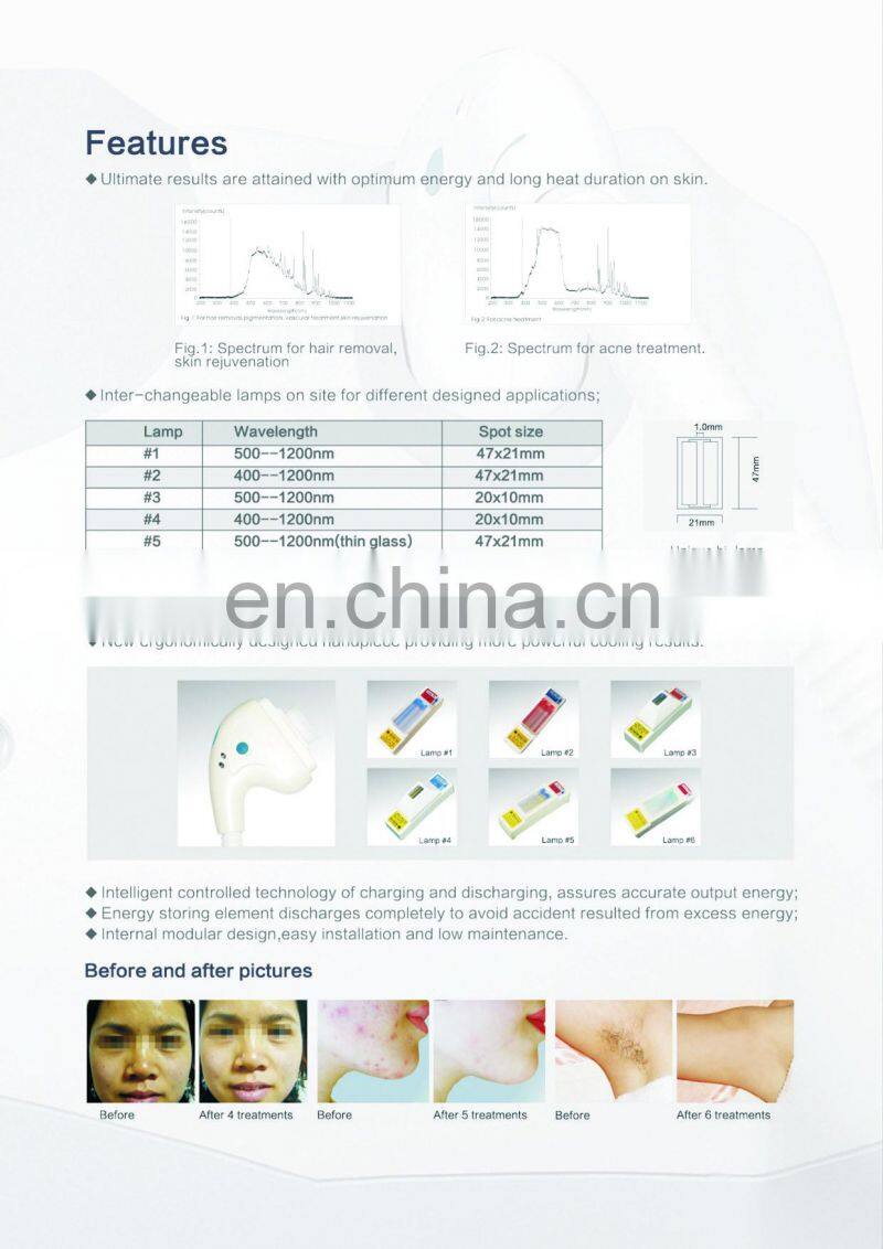 GSD NEW ipl permanent hair epilator face lift skin rejuvenation machine
