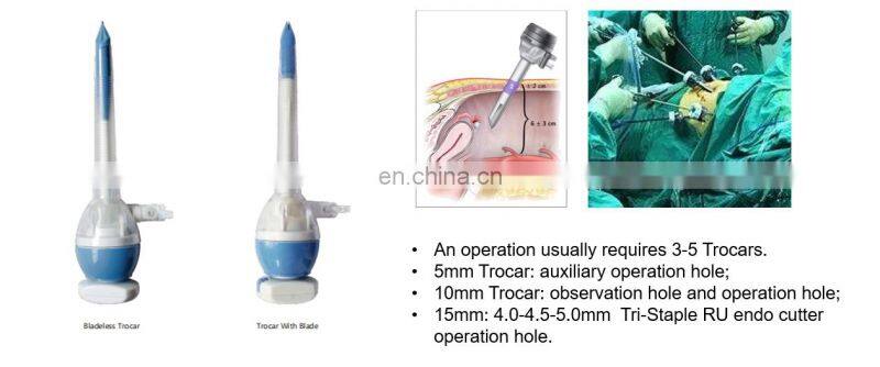 2021 Wholesale 2021 Feng Plastic Disposable Trocar