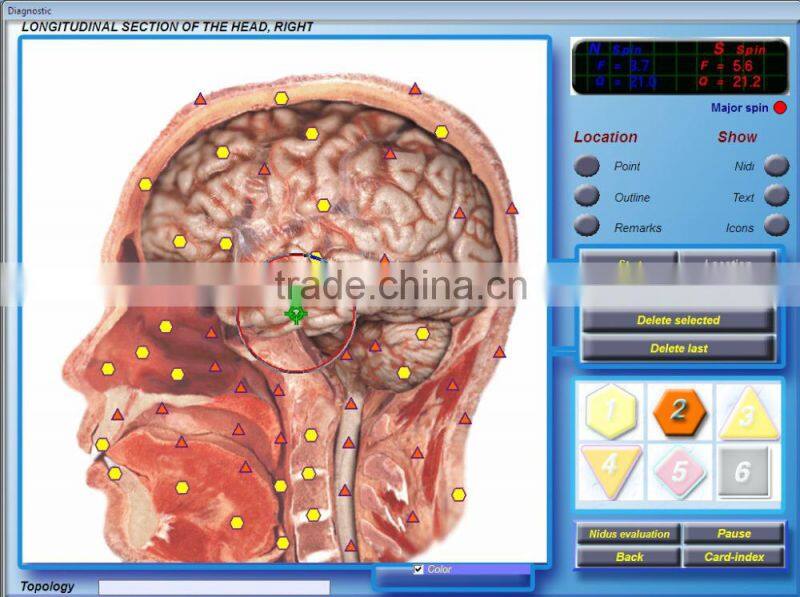 Quantum Analyzer 3D body health analyzer