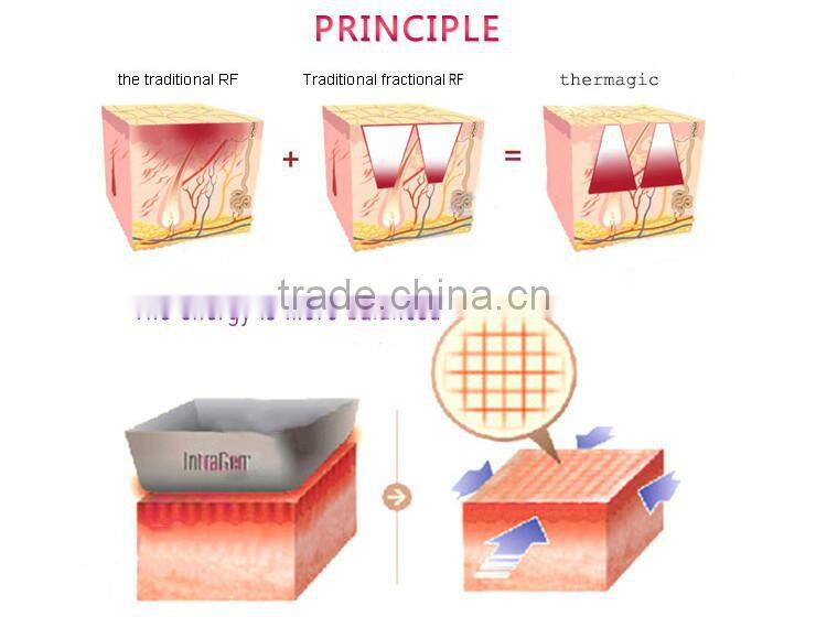 5MHz automatic detection function handheld fractional rf Skin Tightening machine