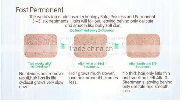 Home Use Professional Hair Removal 808 Diode Laser Portable